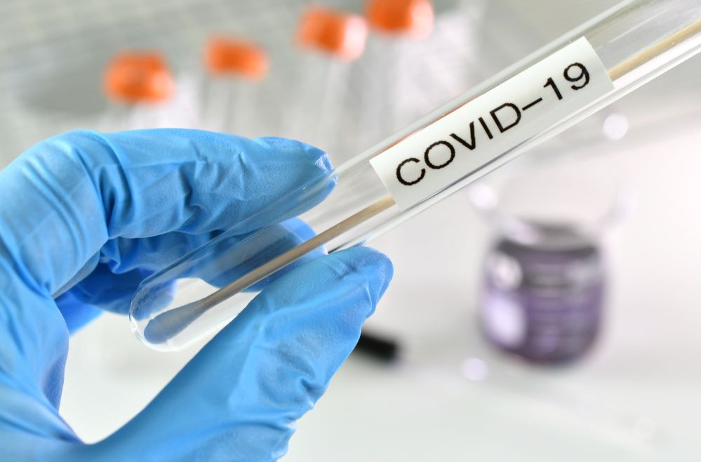 Προμήθεια rapid test για τους επισκέπτες των νησιών από την Περιφέρεια Νοτίου Αιγαίου